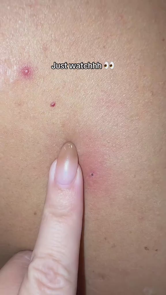 Peel Shot spray application demonstration